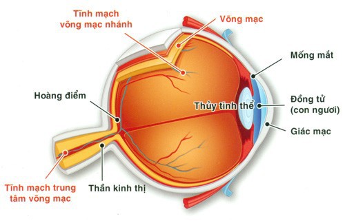 Tắc tĩnh mạch trung tâm VM