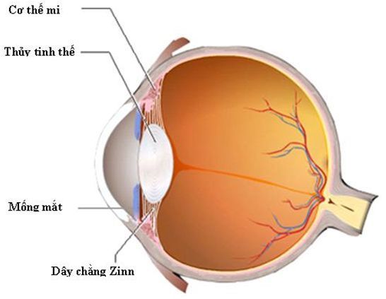 BỆNH ĐỤC THỦY TINH THỂ VÀ NHỮNG ĐIỀU CẦN BIẾT