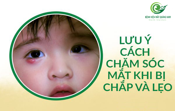 CHĂM SÓC MẮT KHI BỊ CHẮP VÀ LẸO